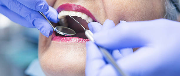 Best Emergency Cosmetic Dentistry (e.g., broken veneers) in Spring City, TN